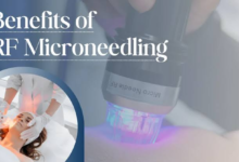Discover the Transformative Benefits of RF Microneedling for Skin Rejuvenation