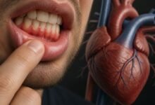 Gum Disease and Heart Health